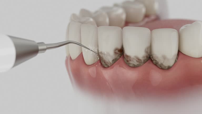 Reliable Dental Implants contractor in Dellwood, MO by Smile Center Dentistry